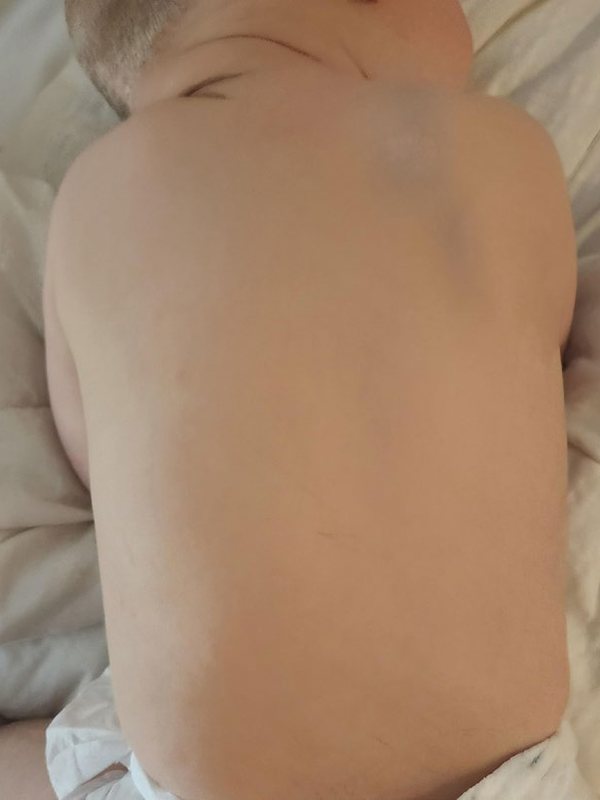 After